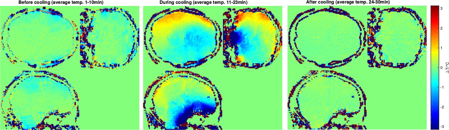 A temperature effect you can see