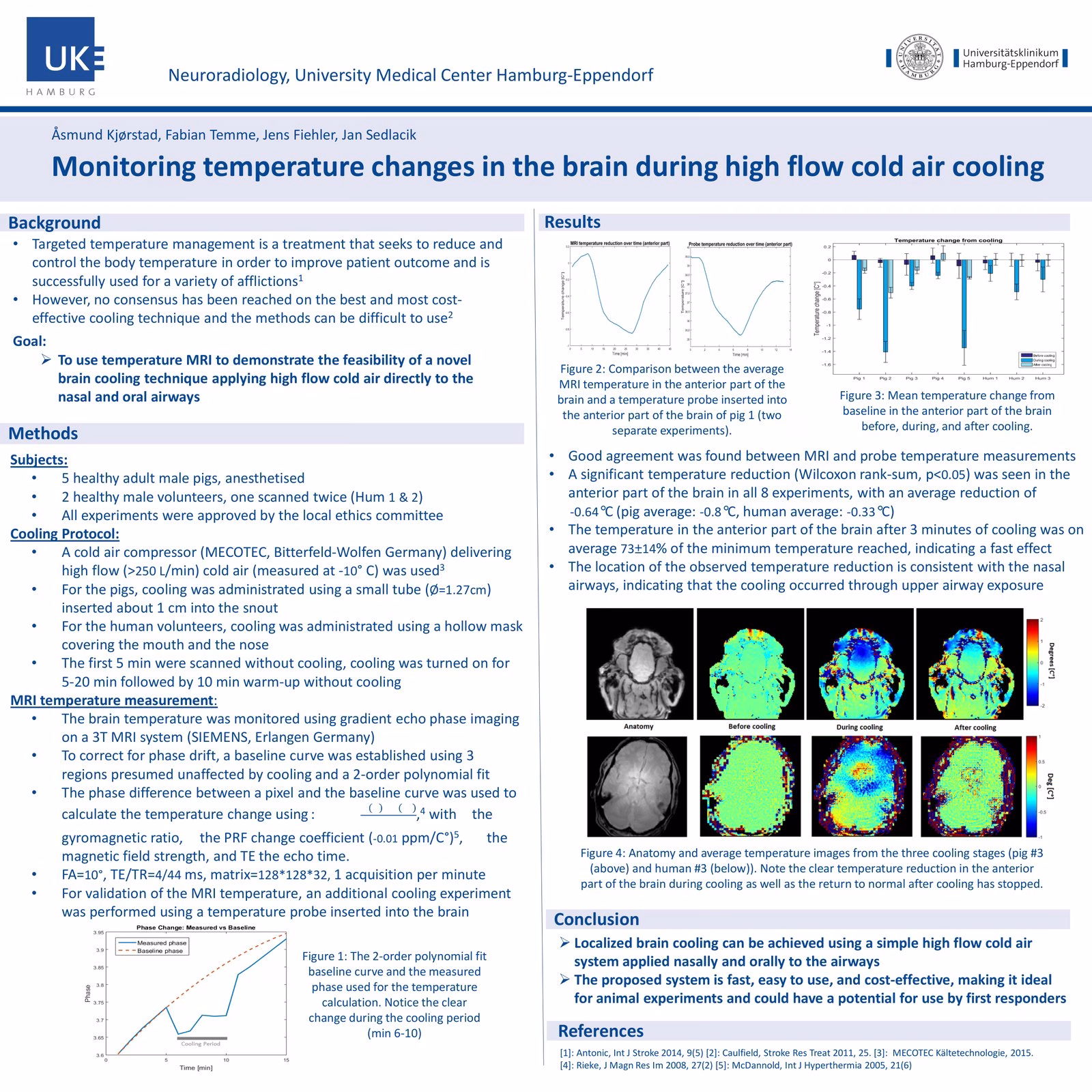 Poster presented at the 24th ISMRM Annual Meeting, Singapore 2016, awarded Magna cum laude.