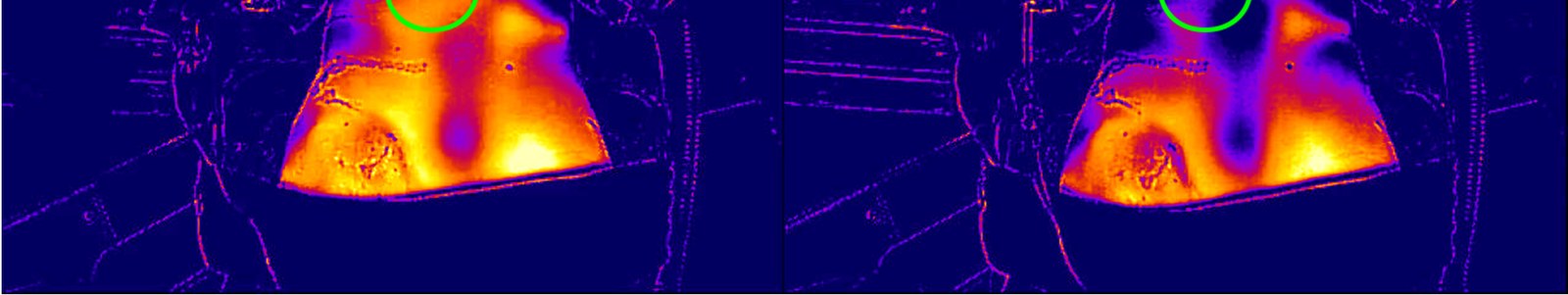 Thermal imaging during delivery